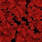 Wat veroorzaakt anemie (bloedarmoede) en wat zijn de tips?